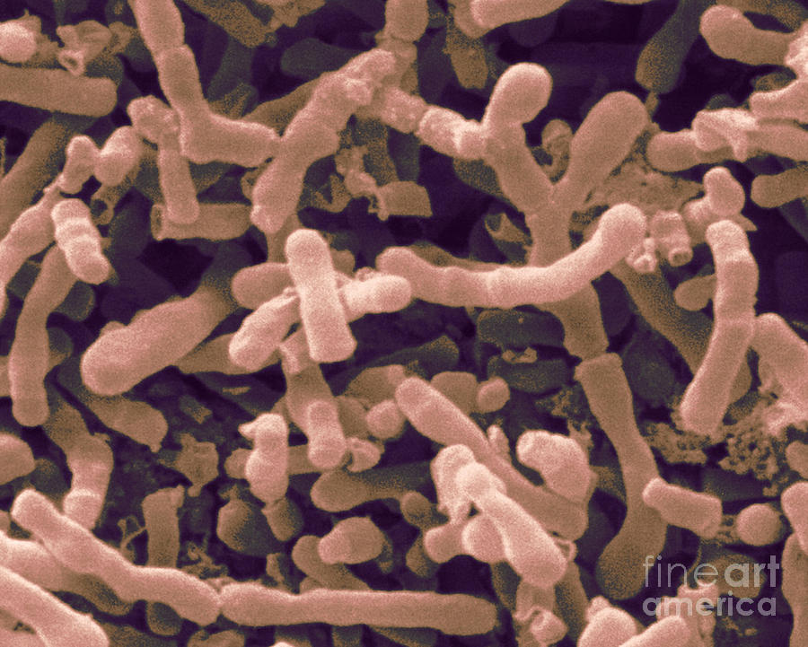 Bifidobacterium Longum, Sem Photograph by Scimat