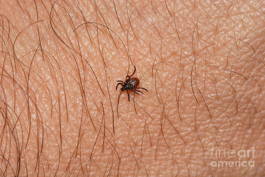 Blacklegged Tick Photograph by John Kaprielian