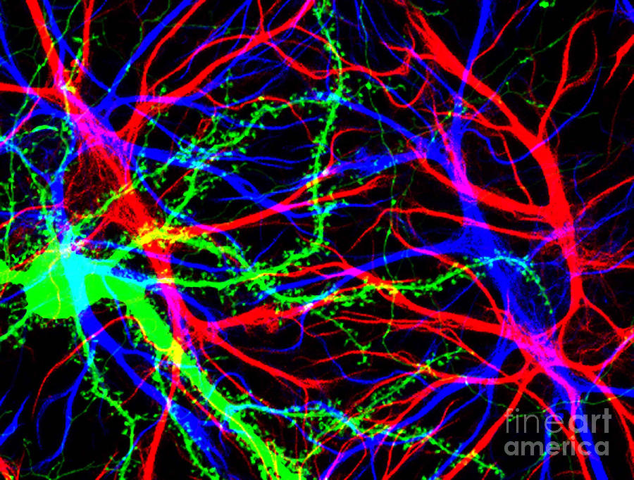 Brain Cells In The Hippocampus Photograph by Science Source