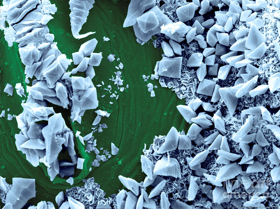 Calcium Oxalate Crystals, Sem Photograph by Scimat