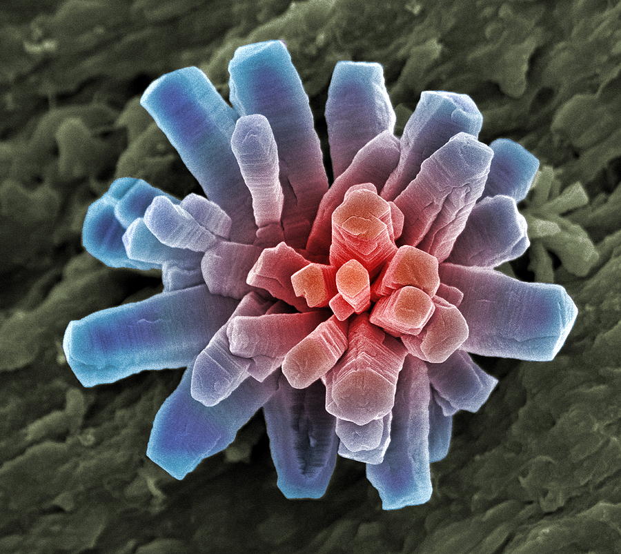 Calcium Phosphate Crystal, Sem Photograph by Steve Gschmeissner