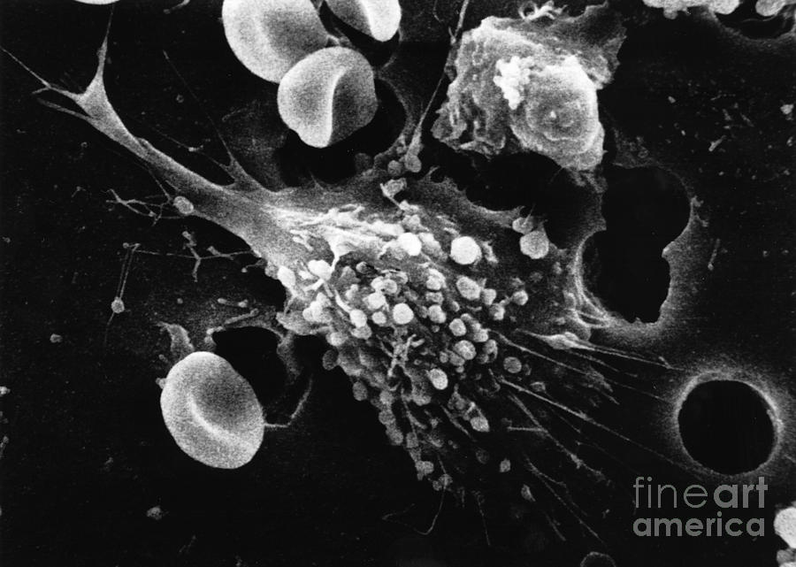 Cancer Cell Death, Sem 1 Of 6 Photograph by Science Source
