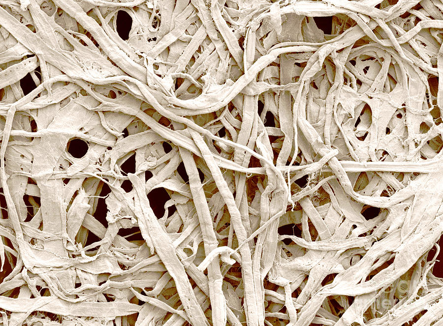 Cellulose Fibers In A Paper Towel Photograph by Scimat