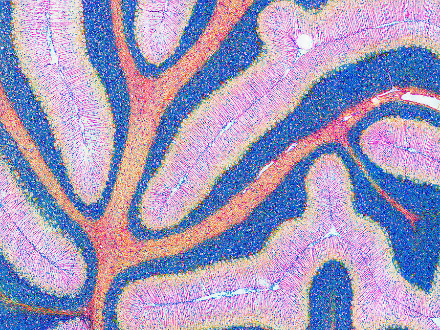 Purkinje Cell Photograph - Cerebellum Structure, Light Micrograph by Thomas Deerinck, Ncmir