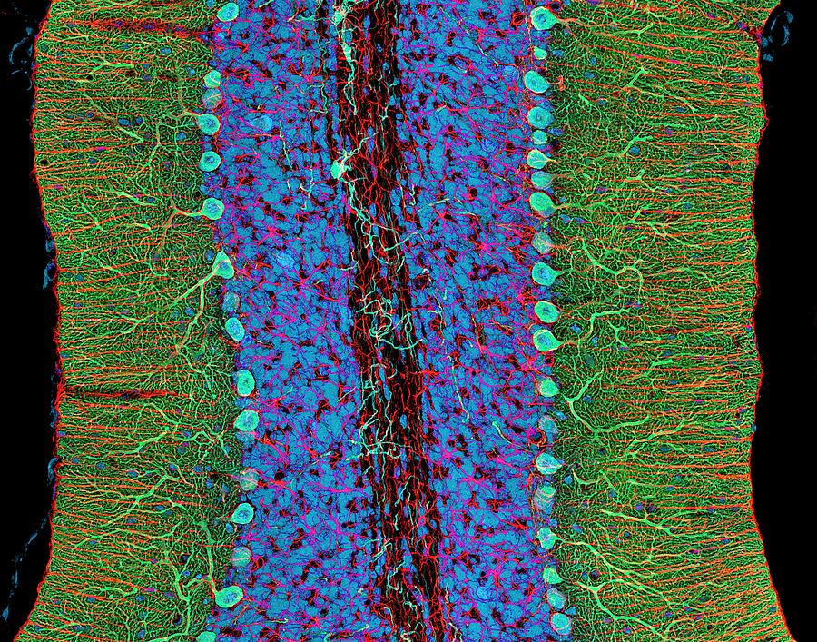 Purkinje Cell Photograph - Cerebellum Tissue, Light Micrograph by Thomas Deerinck, Ncmir