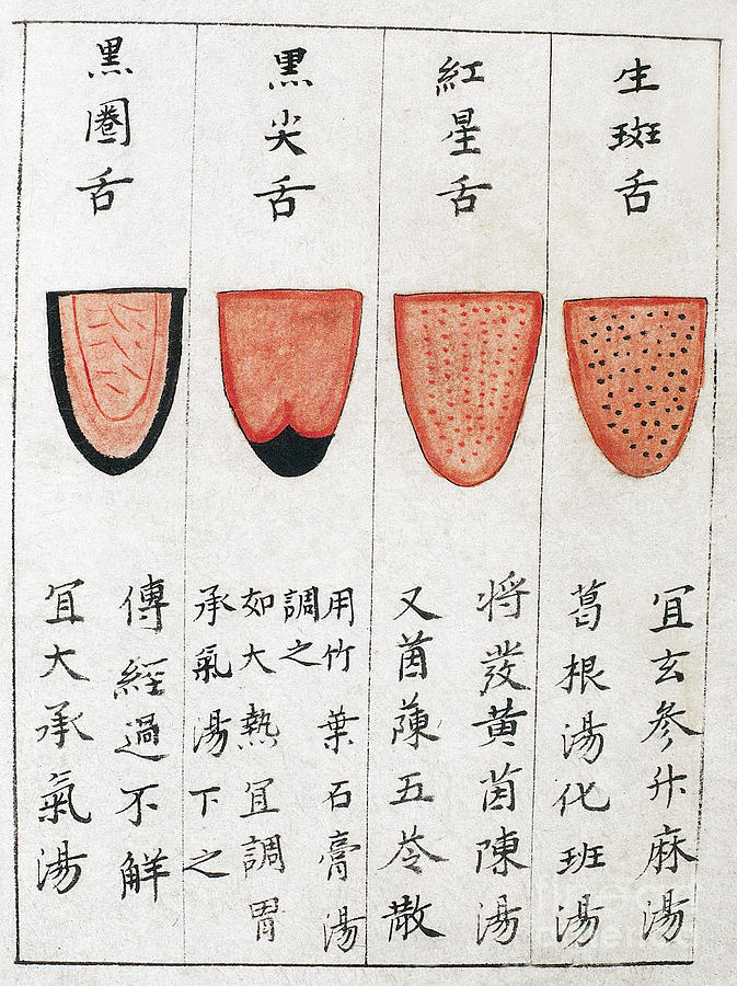 Chinese Tongue Diagnosis Chart, 1341 Photograph by Wellcome Images