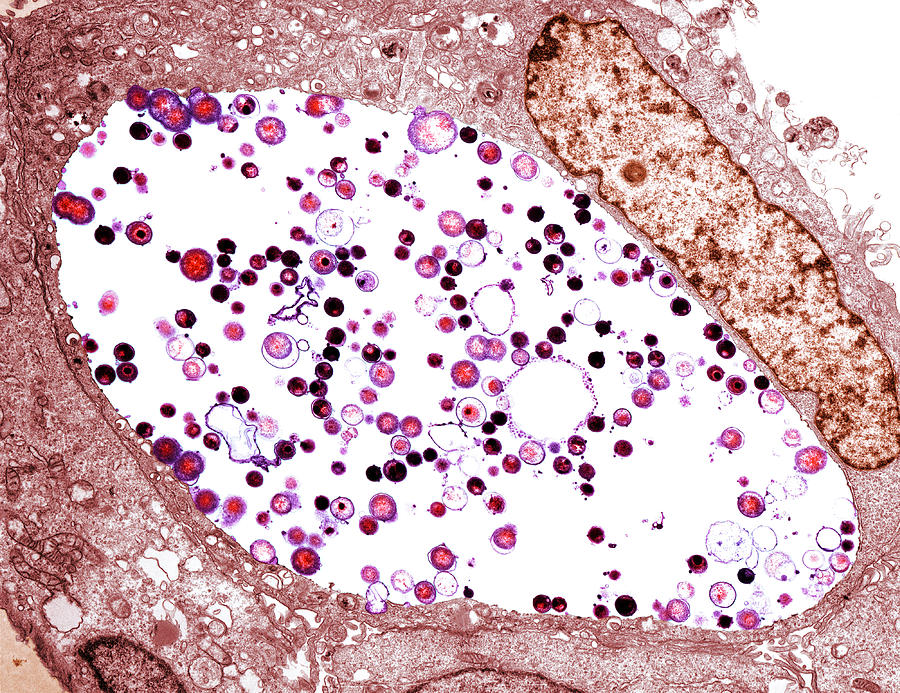 Chlamydia Trachomatis Photograph - Chlamydia Trachomatis Bacteria, Tem by Biomedical Imaging Unit, Southampton General Hospital