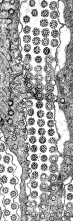 Cilia and Basal Bodies TEM Photograph by Greg Antipa