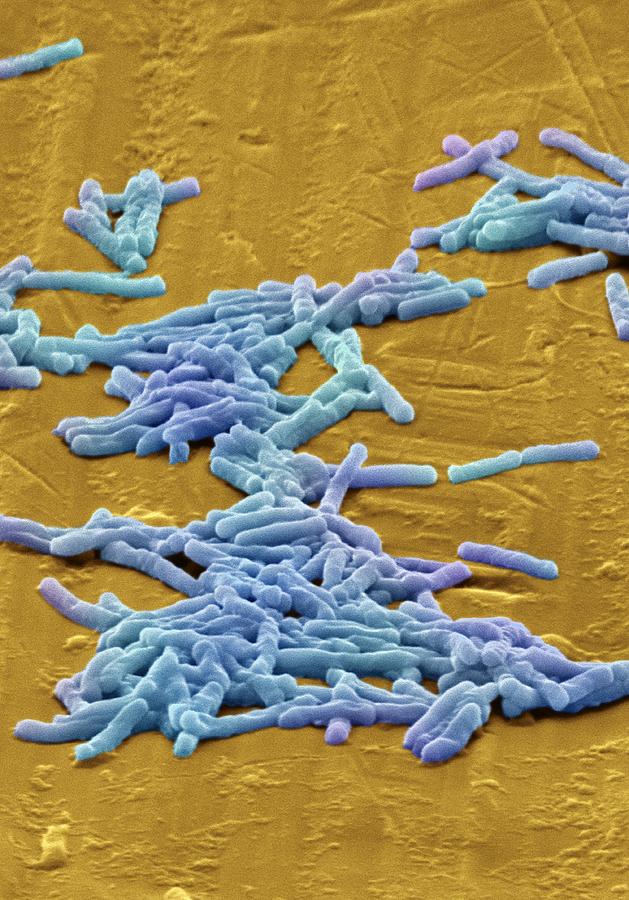 Clostridium Difficile Photograph - Clostridium Difficile Bacteria, Sem by David Mccarthy