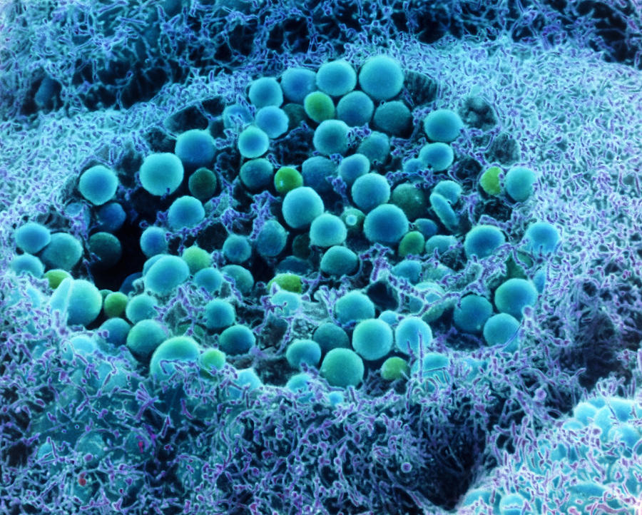 Col. Sem Of Eye Melanocyte Cell & Pigment Granules Photograph by Steve Gschmeissner