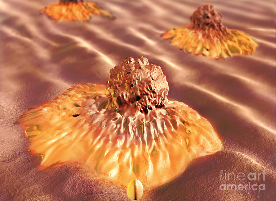 Colon Cancer Cells, Illustration Photograph by Spencer Sutton
