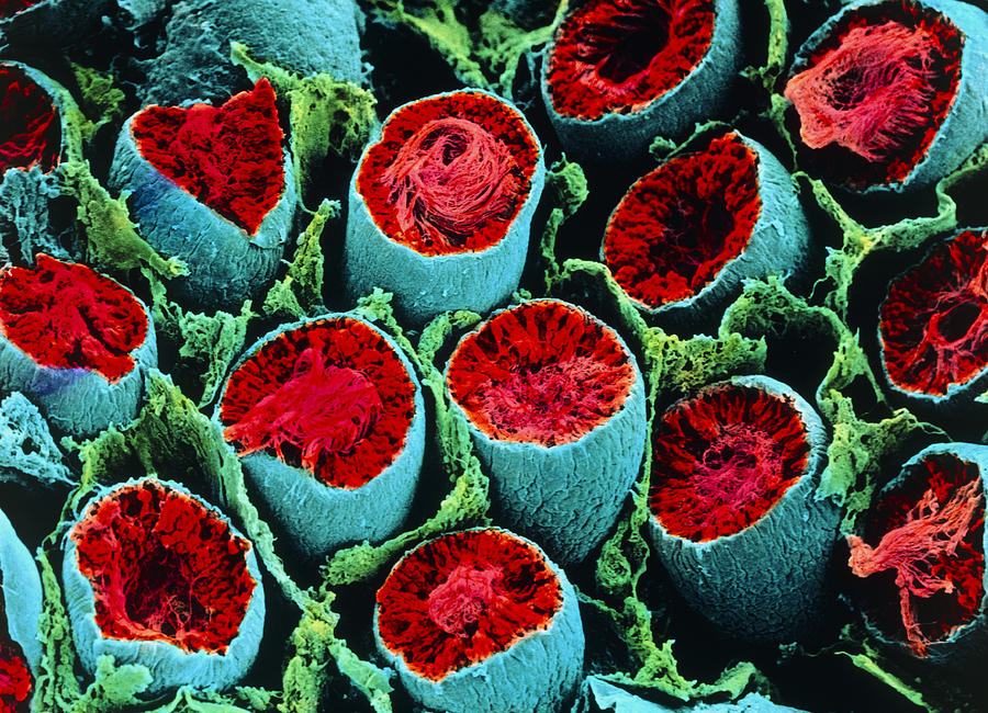 Colour Sem Of Seminiferous Tubules Of The Testis Photograph by Cnri