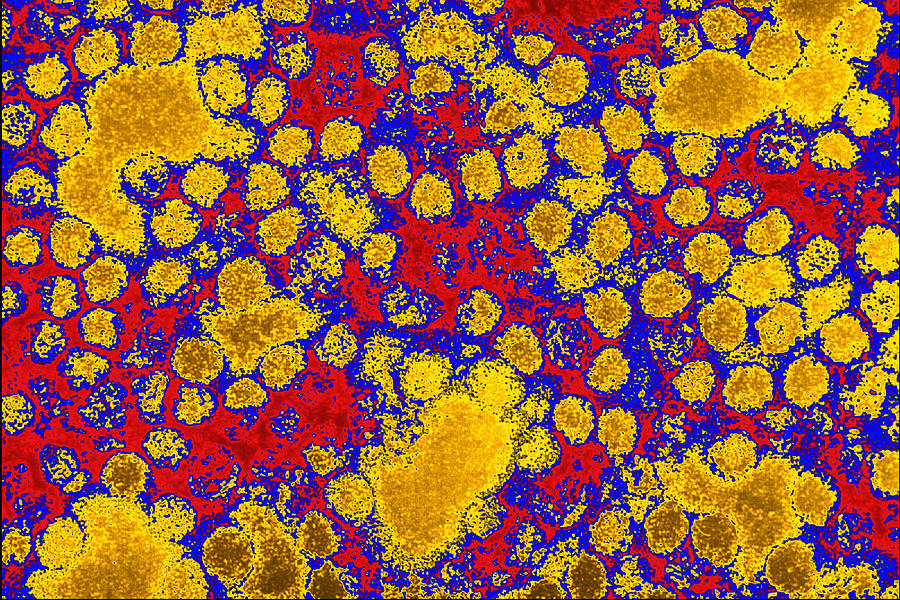 Coloured Tem Of Yellow Fever Viruses Photograph by Cdc - Pixels