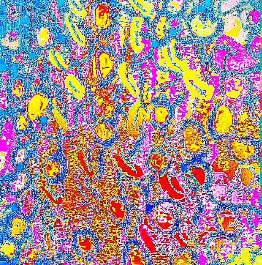 Coral Explosion Pastel by Brenae Cochran