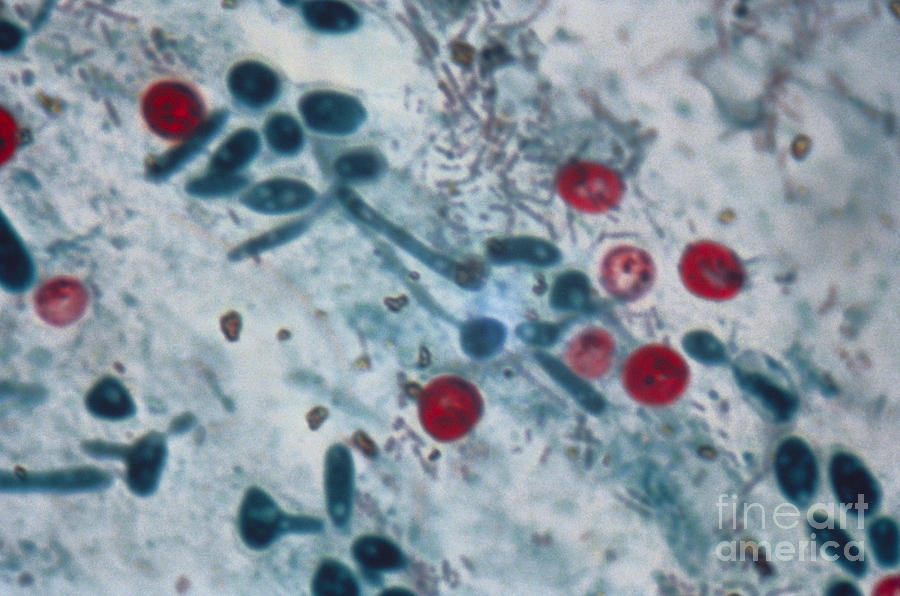 Histology Photograph - Cryptosporidium Parvum Lm by Science Source