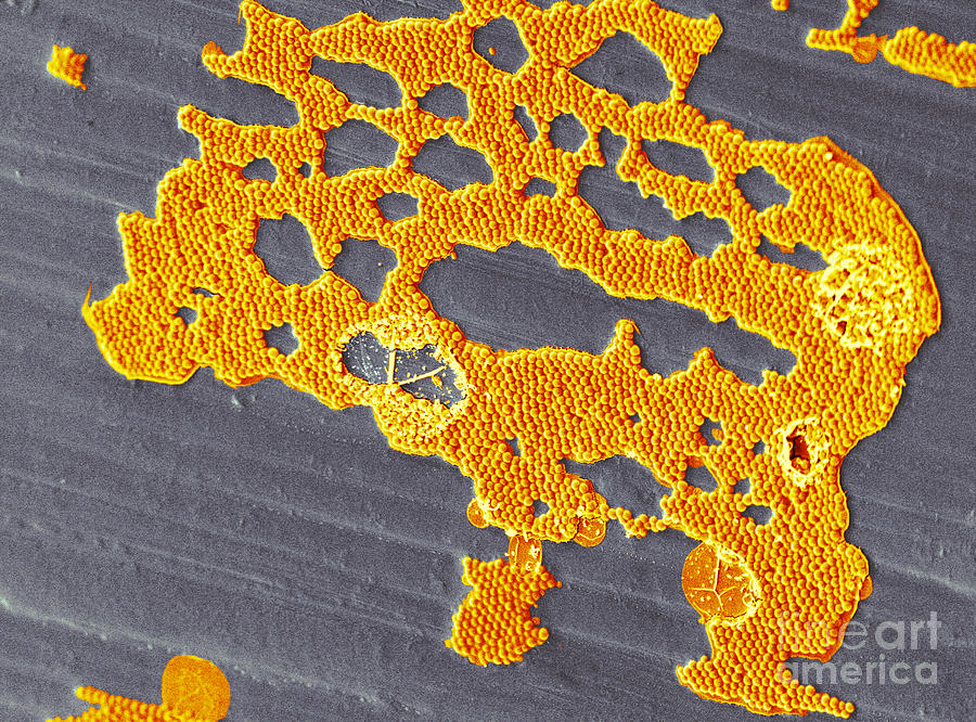 Cultured Bacterial Biofilm Photograph by Scimat