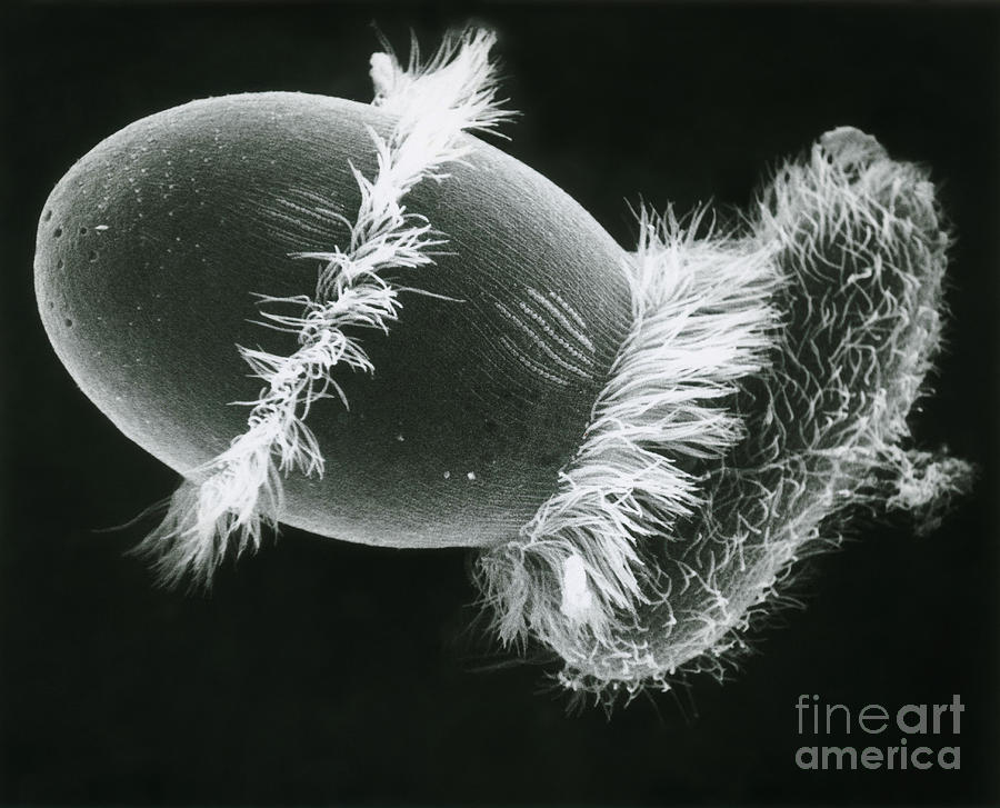 Didinium Ingesting A Paramecium Photograph by Greg Antipa