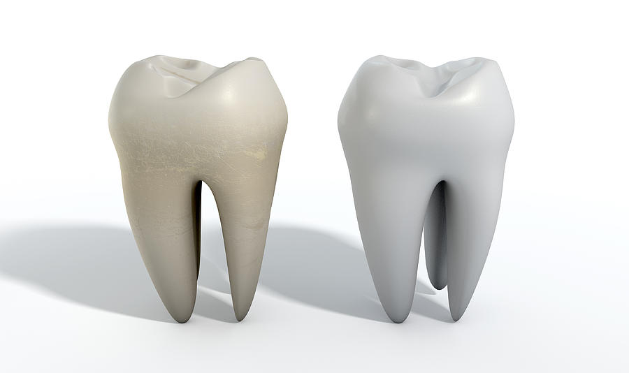Teeth Digital Art - Dirty Clean Tooth Comparison by Allan Swart