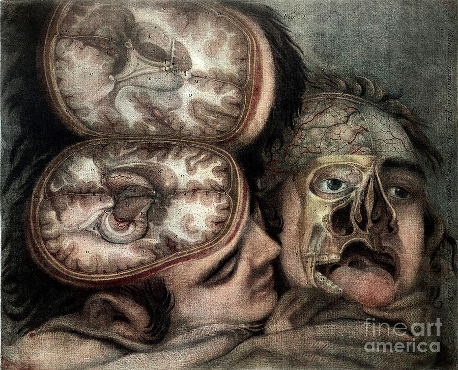 Dissected Brain And Face, Illustration Photograph by Wellcome Images
