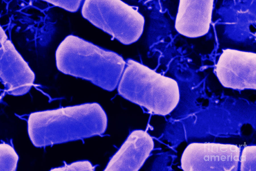 Dividing Bacteria Photograph by Scimat