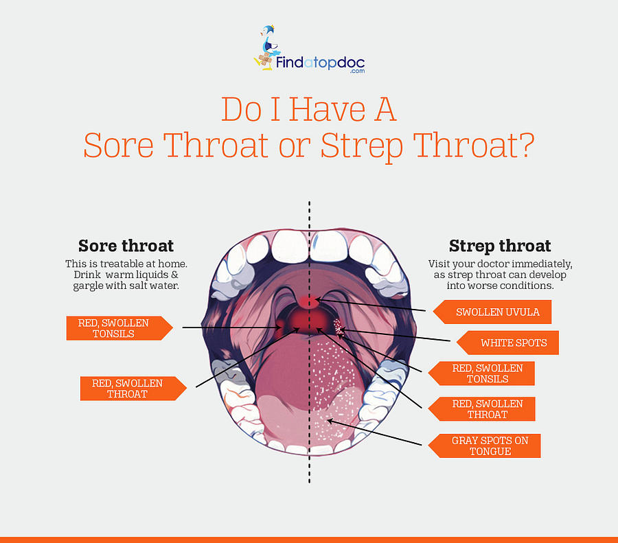 strep throat vs sore throat