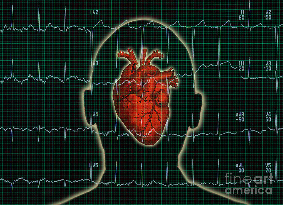 Ekg And Heart Over Head Photograph by George Mattei