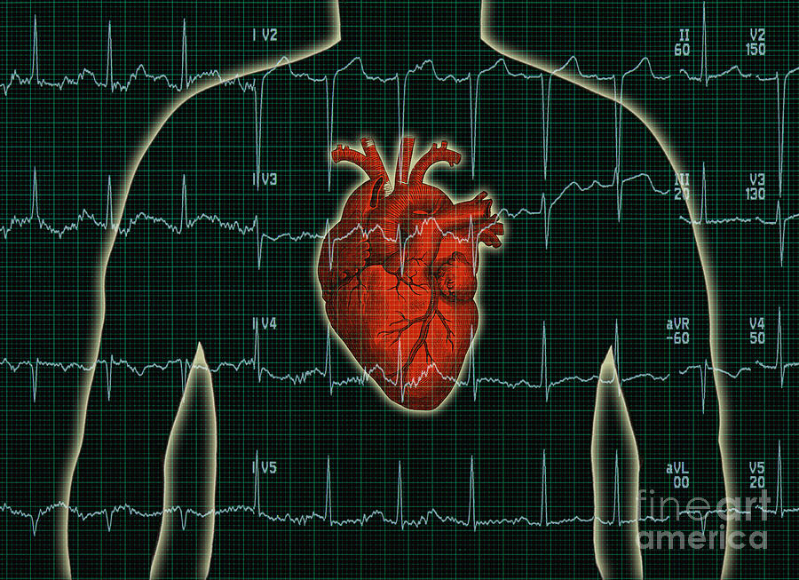 Ekg And Heart Over Torso Photograph by George Mattei