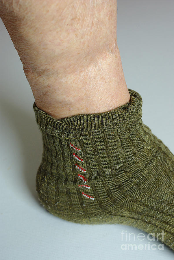 Elastic In Socks Impairs Blood Flow Photograph by Scimat
