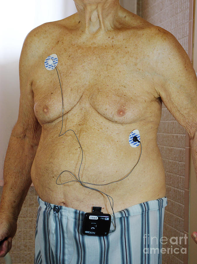 Elderly Man With Cardiac Event Recorder Photograph by Scimat