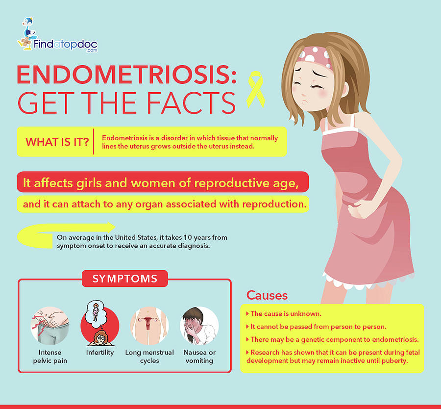 endometriosis belly