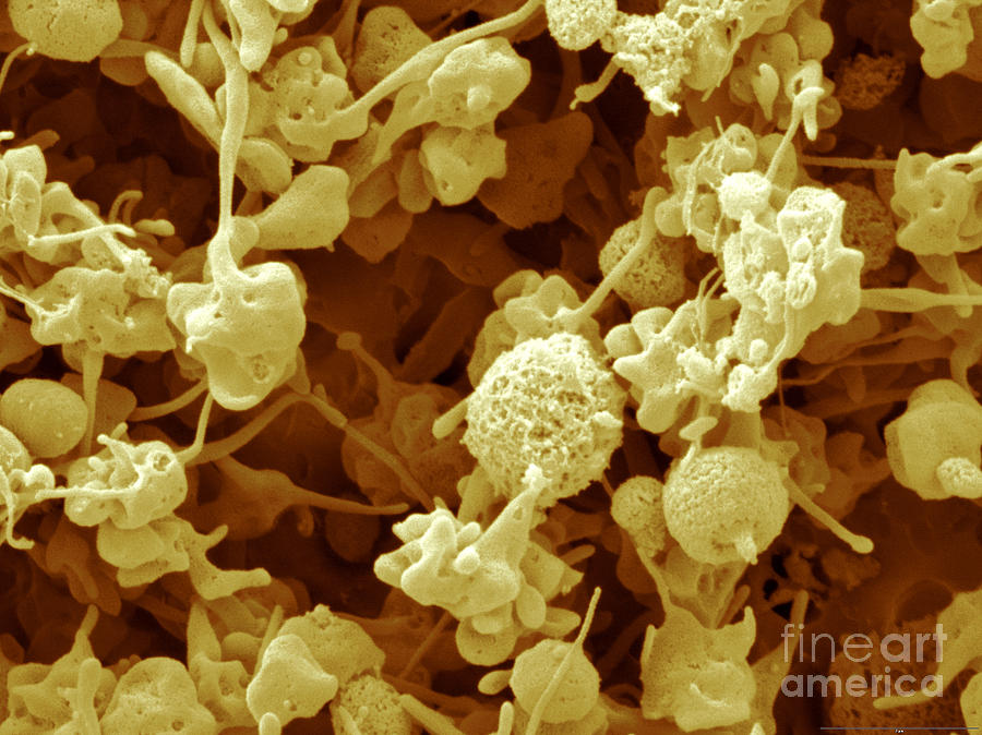 Excited Human Platelets Photograph by Scimat