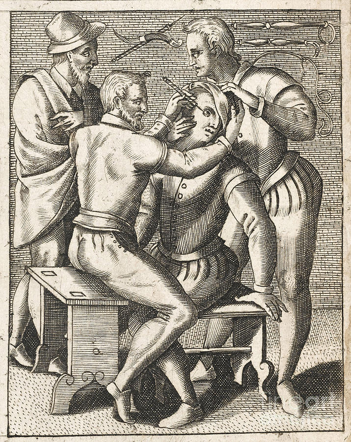 Eye Surgery And Surgical Tools, 1594 Photograph by Wellcome Images