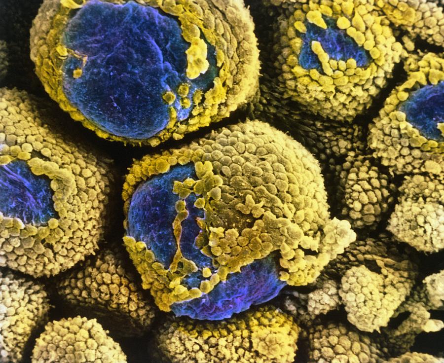 Images Photograph - False-colour Sem Of Polycystic Ovary by Professors P.m. Motta & S. Makabe