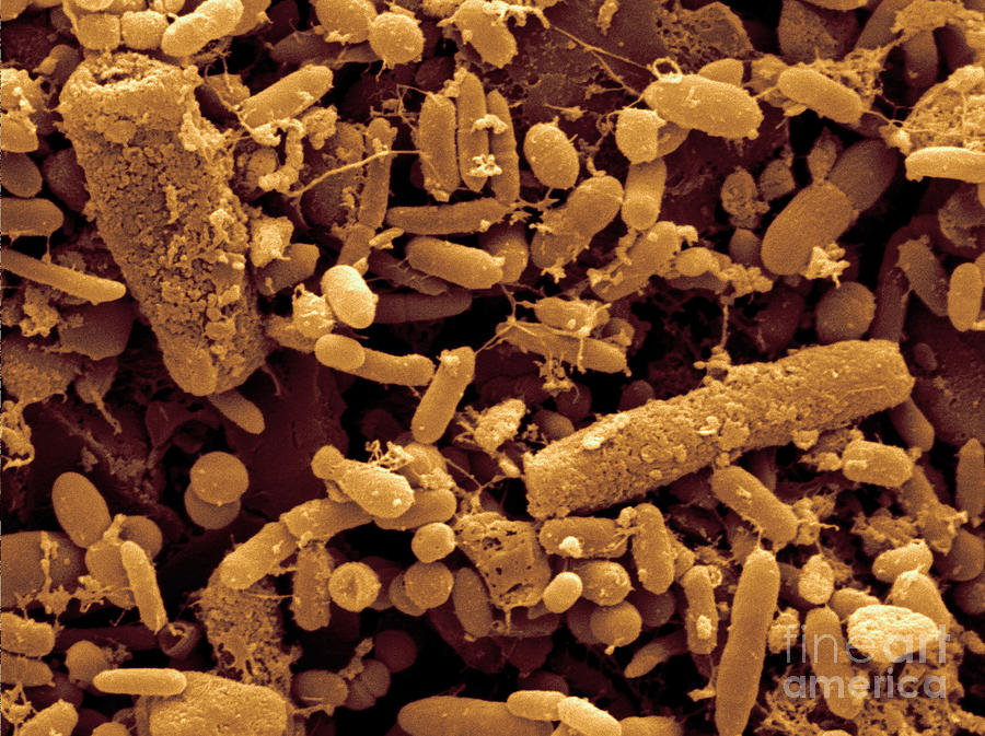 Fecal Bacteria Photograph by Scimat