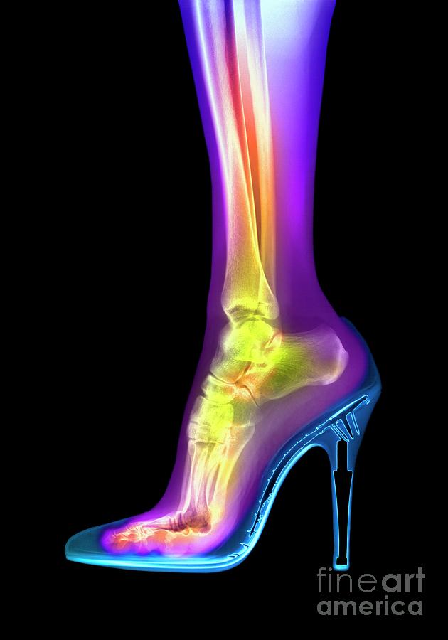 Foot In High Heel Xray Photograph by Spl