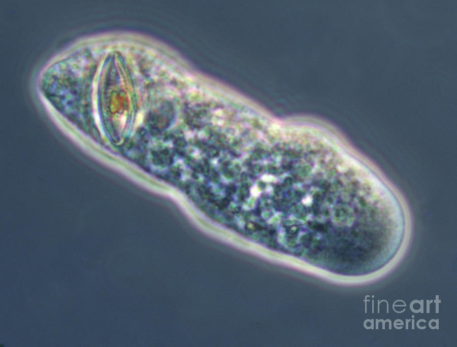 Freshwater Amoeba with Diatoms LM Photograph by Greg Antipa