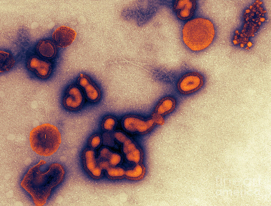 H1n1, Influenza A, Russian Flu, Tem Photograph by Science Source