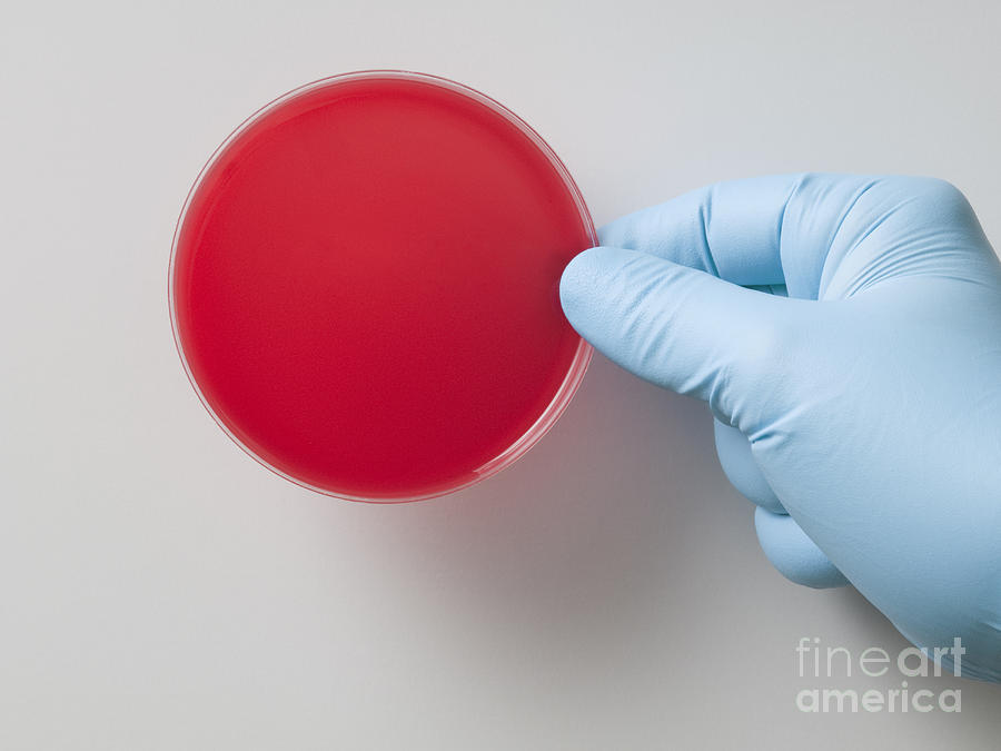 Hand Holding Petri Dish Photograph by George Mattei