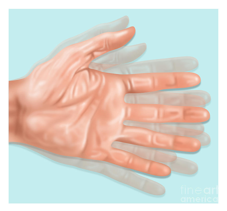 Hand Tremors, Illustration Photograph by Gwen Shockey