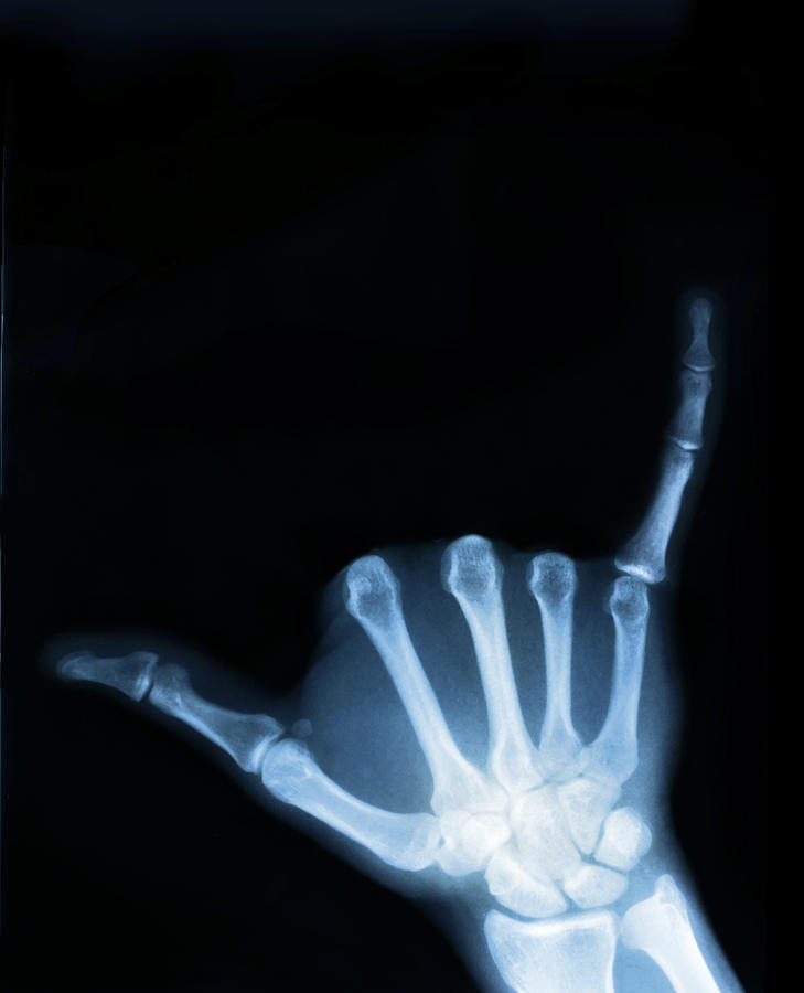 X-ray Photograph - Hang Loose by Gravityx9 Designs