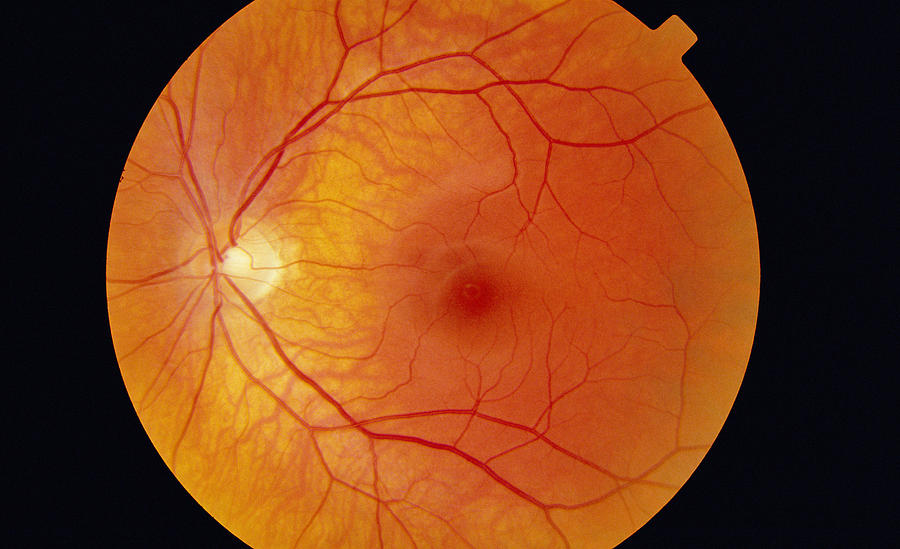 Healthy Retina Photograph by Paul Parker