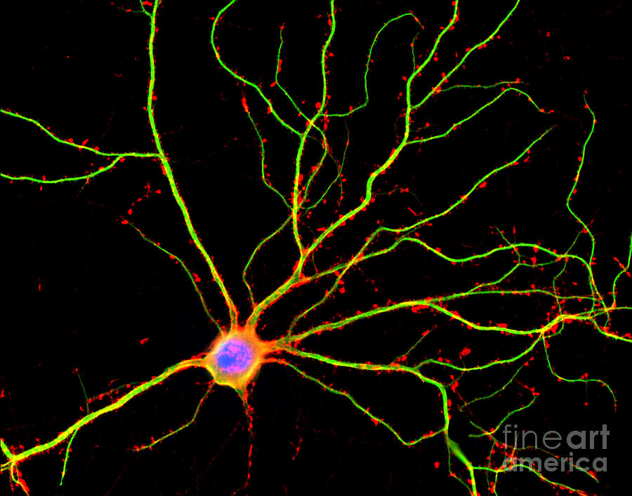 Hippocampal Neuron In Culture Photograph by Science Source