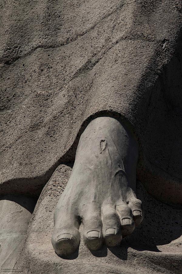 His Foot And Wound Photograph by Hany J