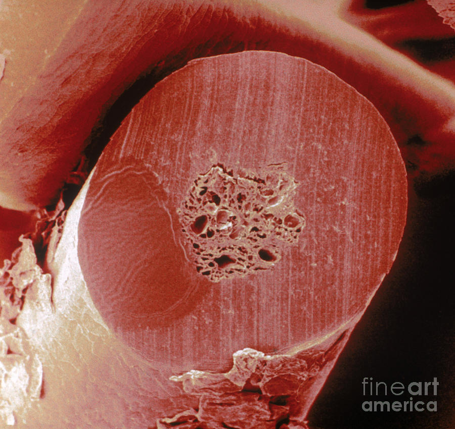 Human Beard Hair Photograph by Scimat Fine Art America