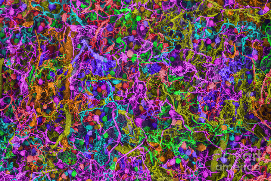 Human Brain Cells, Sem Photograph by Ted Kinsman
