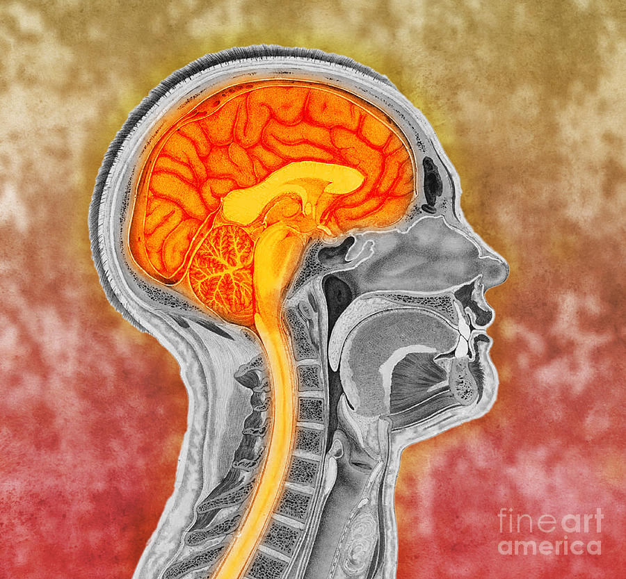 Human Brain, Colorized Illustration Photograph by Scott Camazine