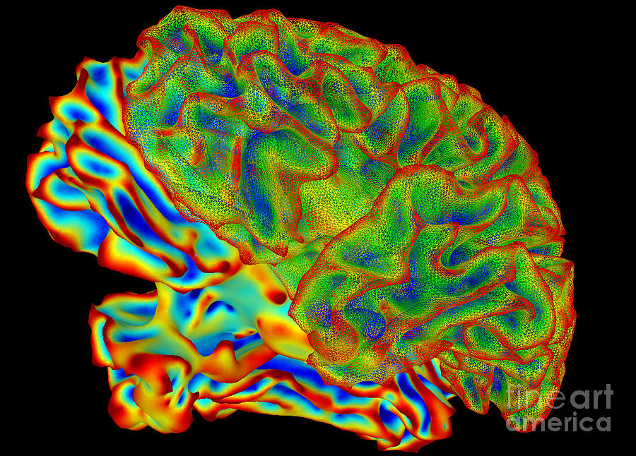 Human Brain, Surface Mapping Photograph by Science Source