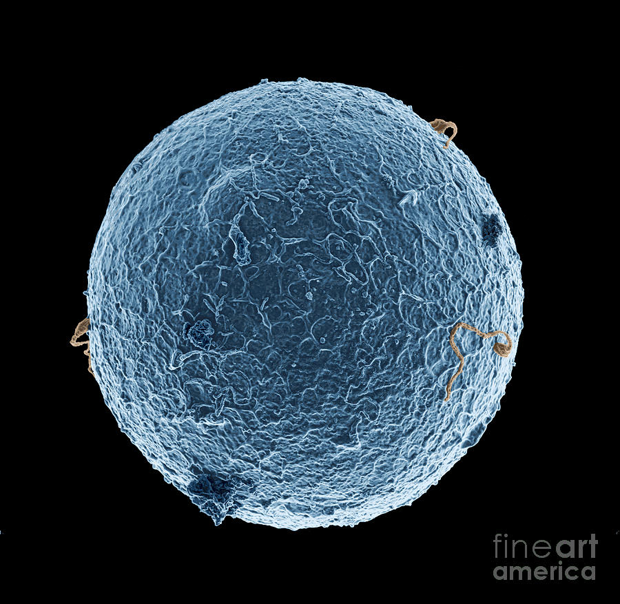 Human egg cell and sperm cells ESEM Photograph by Spl