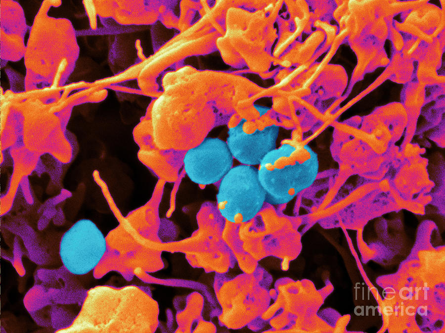 Human Platelets & Staphylococcus, Sem Photograph by Scimat