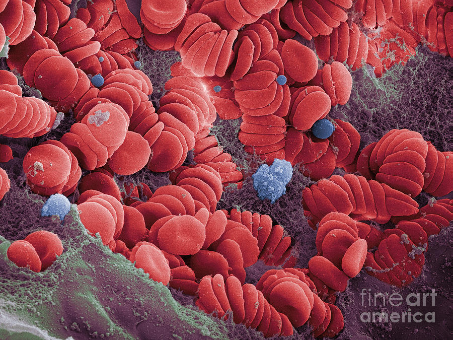 Human Red Blood Cells, Sem Photograph by Ted Kinsman